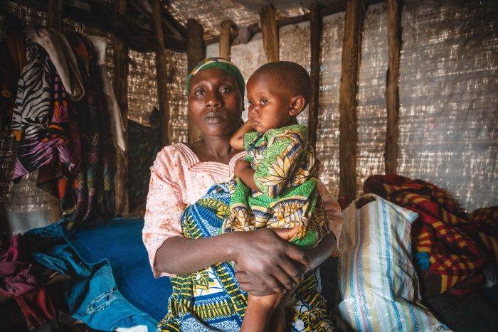 Desnutrición infantil en África Central.