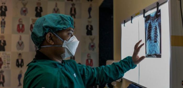 Uno de nuestros médicos interpreta la radiografía de tórax de una niña de 6 años con tuberculosis multi resistente (MDR) en Mumbai, India. Marzo de 2021Atul Loke