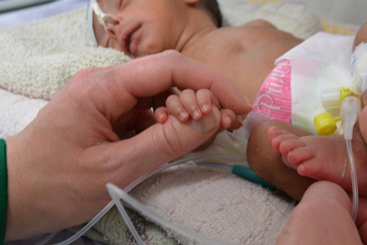 Atendemos a un bebé que nació prematuramente, a mediados del mes siete y pesando solo 1,2 kilogramos, en el Hospital Al-Salam en Khamer, Yemen. Febrero de 2020