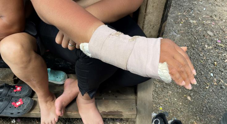 Migrante de Tulua, Valle del Cauca, Colombia, cruzó la frontera del Darién unas semanas después de ser operada de una fractura de muñeca.