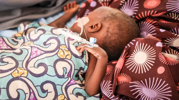 Un niño ingresado en el centro de alimentación terapéutica intensiva de MSF en Katsina, Nigeria