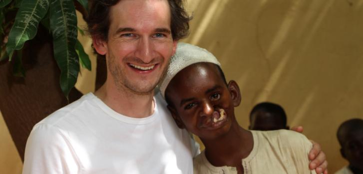 Thomas Hoare, psicólogo clínico, con uno de los pacientes antes de la cirugía facial por noma. ©MSF