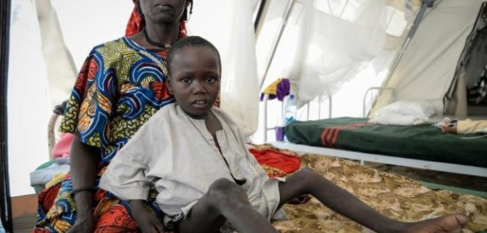 Mustafa Mohammad tiene 7 años y pesa 14 kilos. Está internado en el centro nutricional de MSF en Madiguri, Nigeria ©Aurelie Baumel/MSF