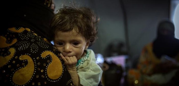 Jawad tiene 10 meses de edad y padece desnutrición. Ya lo estamos atendiendo en nuestro Centro de Nutrición Terapéutica Intensiva del hospital de Qayyara, en el sur de Mosul. ©Hussein Amri/MSF