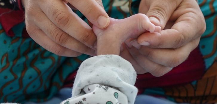 Pequeño pie de un bebé recién nacido en Mosul, Irak.MSF/Maya Abu Ata