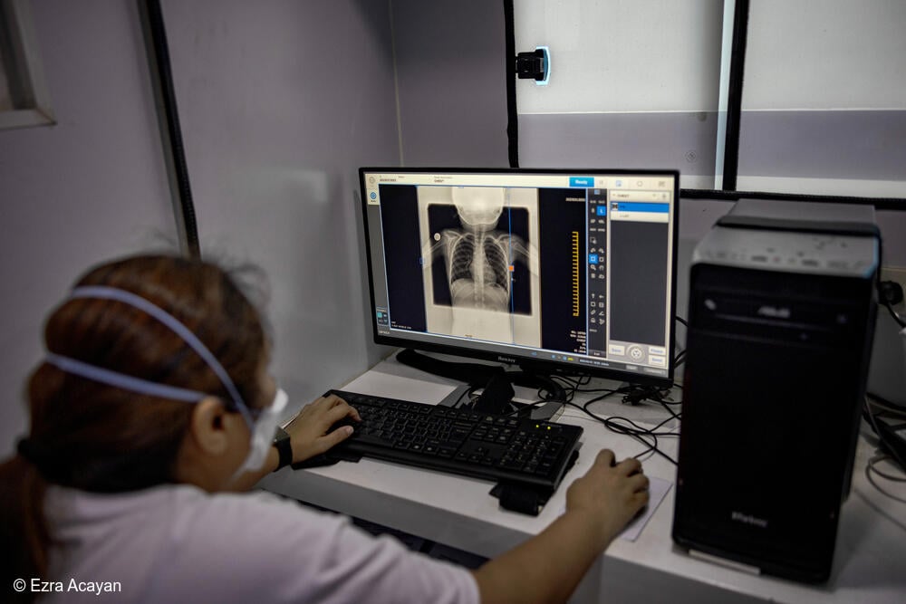 Un miembro del personal de MSF procesa una radiografía de tórax en uno de los puntos de detección activa de casos de tuberculosis.