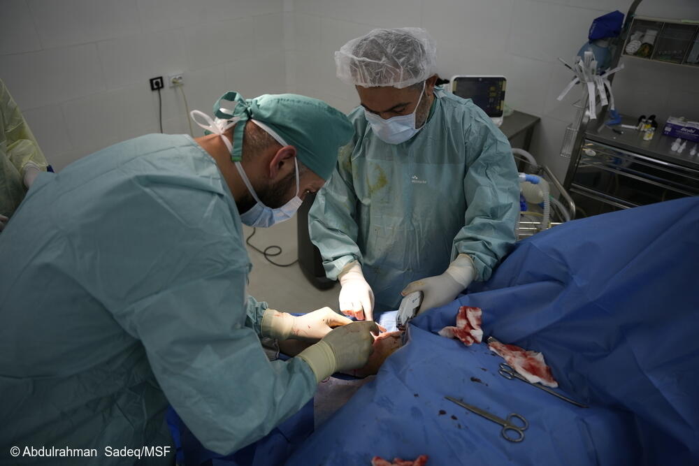 Cirujanos de MSF operan a un paciente con quemaduras en el quirófano del hospital de MSF en Atmeh, al noroeste de Siria.