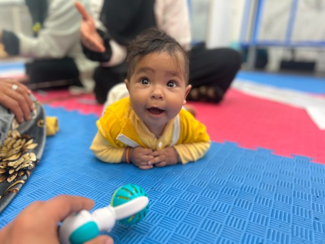 Los equipos de MSF asisten a niños y niñas con desnutrición con rehabilitación pediátrica.