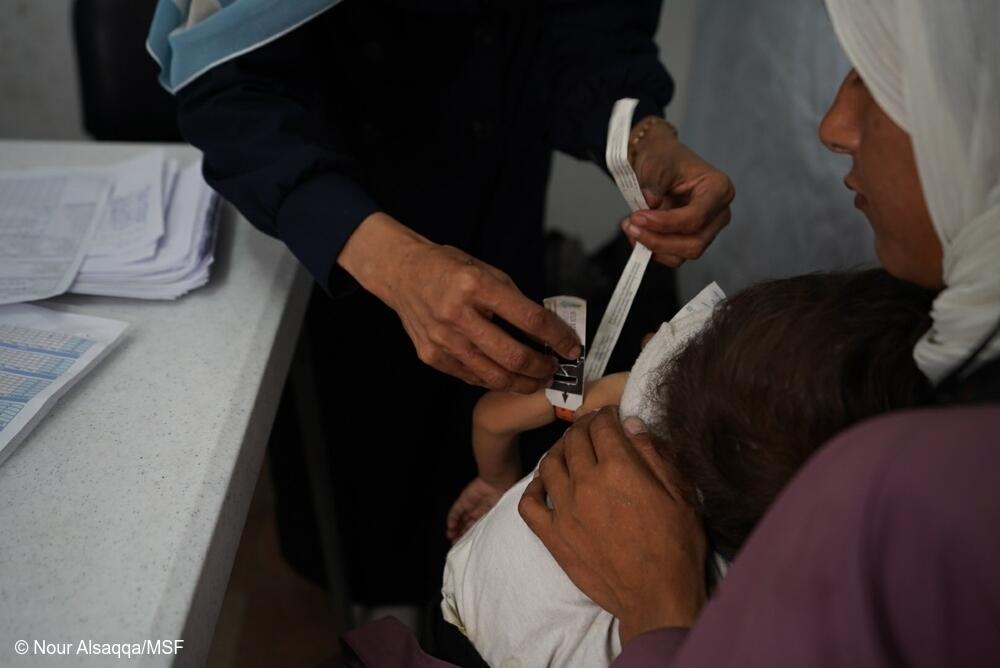 Un niño palestino que sufre desnutrición se somete a un chequeo médico en la clínica de Médicos Sin Fronteras (MSF) en la ciudad de Gaza.