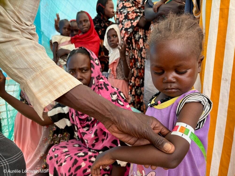 Niña afectado por la crisis nutricional en Sudán siendo atendido por MSF
